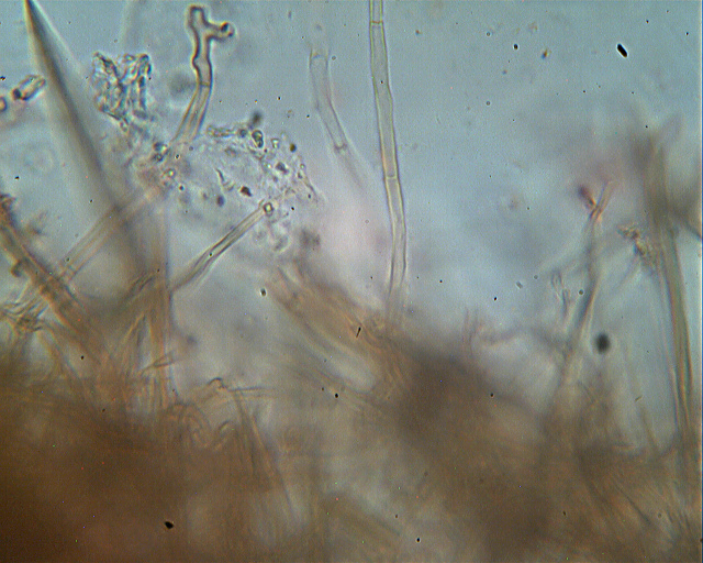 Asterostroma laxum Bres. (1920)